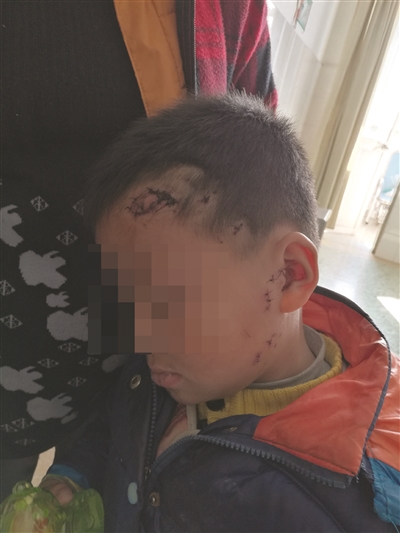 촽С~^Ҳ̎ҧ춦 z